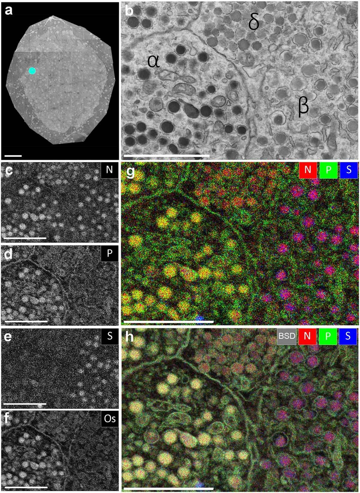 Figure 4: EDX defines cell-types and subcellular structures and organelles in EM images. Credit: Image by Marijke Scotuzzi et al. reproduced under the Creative Commons Attribution 4.0 International license. An example elemental map produced using EDX analysis