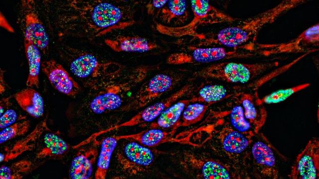 Fluorescent microscopy image showing cellular structures used in spatial transcriptomics research for mapping gene expression. 