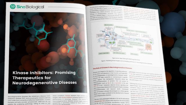 Magazine spread titled "Kinase Inhibitors: Promising Therapeutics for Neurodegenerative Diseases" with text and diagram 