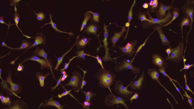 Cell Paint microglia cells. 